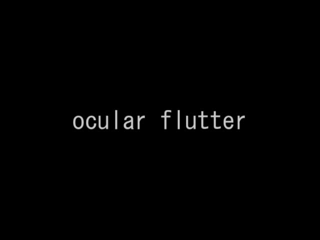 VTR14　ocular flutter（17秒）