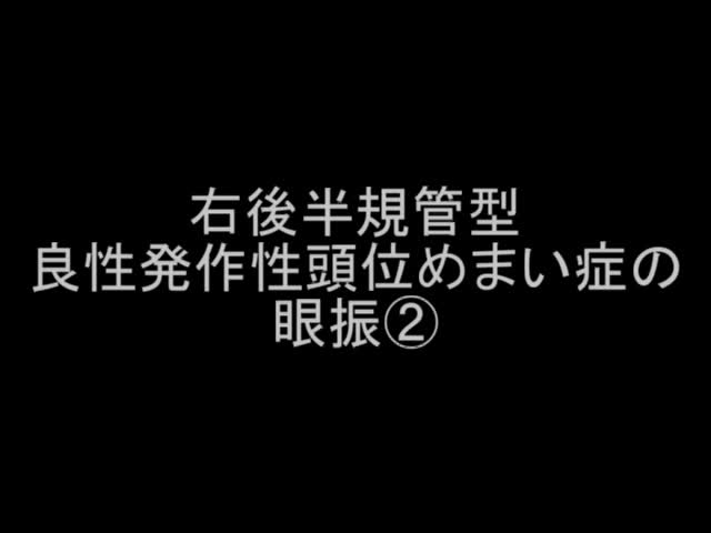 VTR2　右後半規管型良性発作性頭位めまい症の眼振2（26秒）...